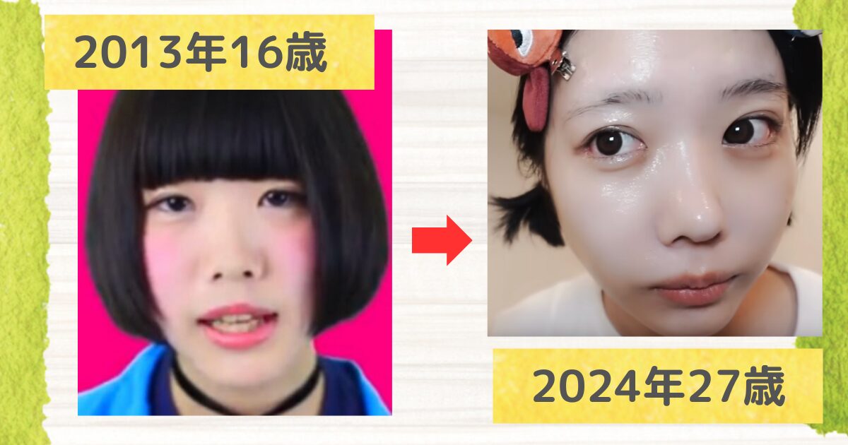 【比較画像】あのちゃん整形は目と鼻？カミングアウトの噂も！ – Sのエンタメ